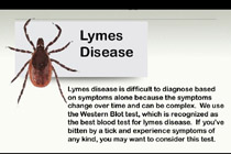 Lymes Disease